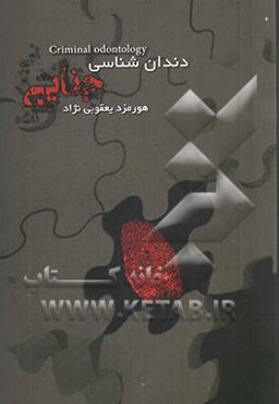 دندان‌شناسی جنایی (نقش دندان در کشف علمی جرائم)