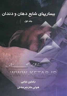 بیماریهای شایع دهان و دندان