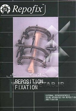 ثابت‌کننده موقعیت استخوان