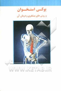 پوکی استخوان و روش‌های پیشگیری و درمان آن