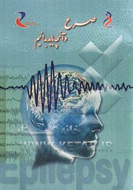 صرع و آنچه باید بدانیم