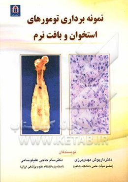 نمونه‌برداری تومورهای استخوان و بافت نرم