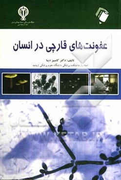 عفونت‌های قارچی در انسان