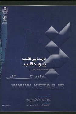 نارسایی قلب - پیوند قلب