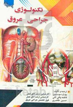 تکنولوژی جراحی عروق