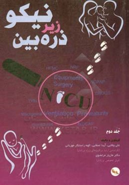 نیکو NICU زیر ذره‌بین