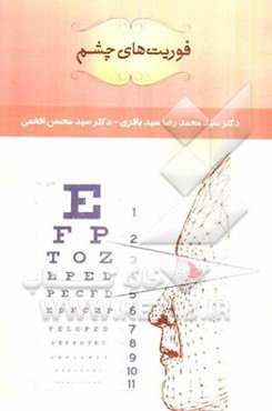 فوریت‌های چشم