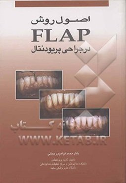 اصول روش Flap در جراحی پریودنتال