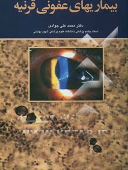 بیماریهای عفونی قرنیه