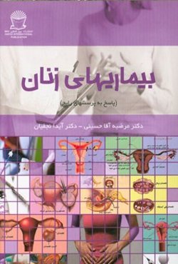 بیماریهای زنان (پاسخ به پرسشهای رایج)