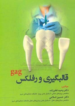 قالبگیری و رفلکس gag