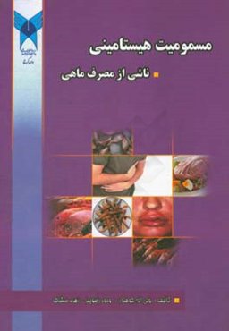 مسمومیت هیستامینی ناشی از مصرف ماهی