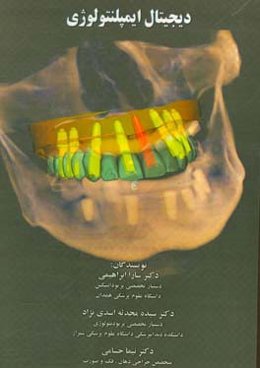دیجیتال ایمپلنتولوژی