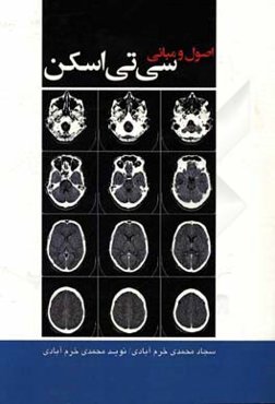 اصول و مبانی سی تی اسکن