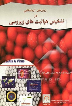 روش‌های آزمایشگاهی در تشخیص هپاتیت‌های ویروسی