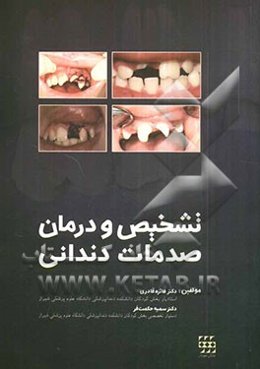 تشخیص و درمان صدمات دندانی