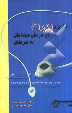 کاربرد پورت در درمان مبتلایان به سرطان