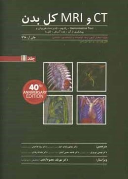 CT و MRI کل بدن: Gastrointestinal tract-رکتوم-کنتراست نفروپاتی و پیشگیری از آن-غدد...