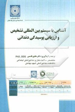 آشنایی با سیستم بین‌المللی تشخیص و ارزیابی پوسیدگی دندانی = International caries detection and assessment system (ICDAS)