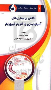 نگاهی بر بیماری‌های آمیلوئیدی و آنزیم لیزوزیم