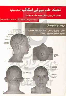 طب سوزنی اسکالپ، سبک جیائو