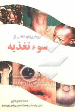 بیماری‌های ناشی از سوء تغذیه