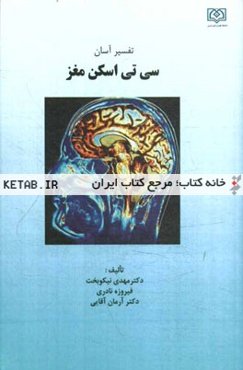 تفسیر آسان سی‌تی‌ اسکن مغز