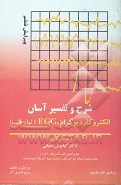 شرح و تفسیر آسان الکتروکاردیوگرام (ECG)