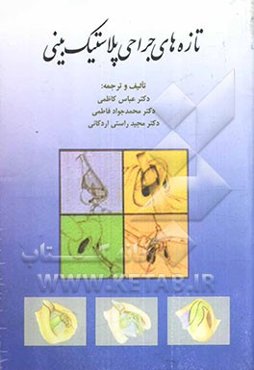 تازه‌های جراحی پلاستیک بینی