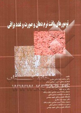 تومورهای بافت نرم دهان و صورت و غدد بزاقی