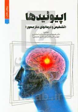 اپیوئیدها (تشخیص و درمان‌های مغز‌محور)