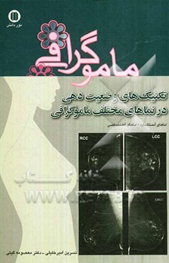 تکنیک‌های وضعیت‌دهی در نماهای مختلف ماموگرافی: نماهای استاندارد - نماهای اختصاصی