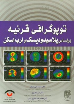 توپوگرافی قرنیه بر اساس پلاسیدودیسک و ارب‌‌اسکن