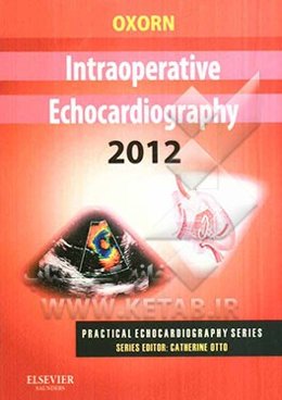 Intraoperative echocardiography