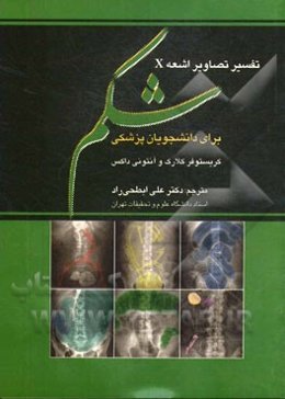 تفسیر تصاویر اشعه X شکم برای دانشجویان پزشکی