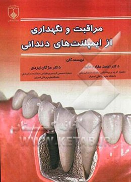 مراقبت و نگهداری از ایمپلنت‌های دندانی