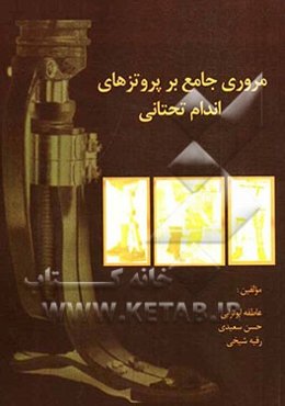 مروری جامع بر پروتزهای اندام فوقانی