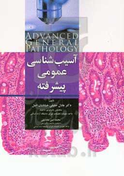 آسیب‌شناسی عمومی پیشرفته