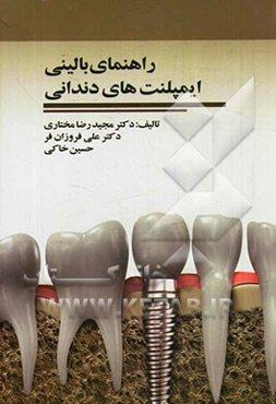 راهنمای بالینی ایمپلنت‌های دندانی