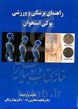 راهنمای پزشکی و ورزشی پوکی استخوان