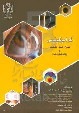 کراتوکونوس: شیوع، علت، تشخیص و روش‌های درمان