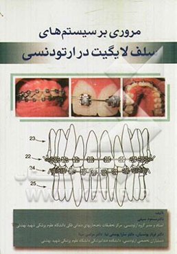 مروری بر سیستم‌های سلف لایگیت در ارتودنسی