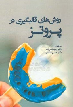 روش‌های قالبگیری در پروتز