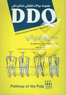 مجموعه سوالات تفکیکی دندانپزشکی: (DDQ) مسیرهای پالپ