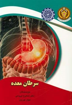 سرطان معده (راهنمای پزشکان و پژوهشگران)