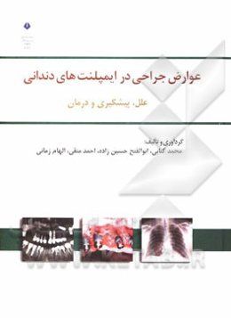 عوارض جراحی در ایمپلنت‌های دندانی: علل، پیشگیری و درمان