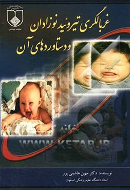 غربالگری تیروئید نوزادان و دستاوردهای آن