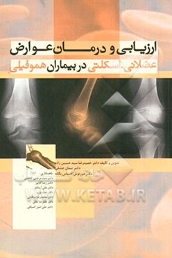 ارزیابی و درمان عوارض عضلانی - اسکلتی در بیماران هموفیلی