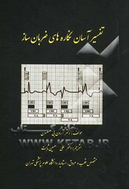 تفسیر آسان نگاره‌های ضربان ساز