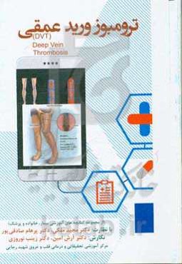 ترمبوز ورید عمقی